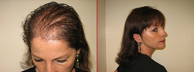 Hairdreams Microlines