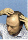 1.Schritt 1.Schritt