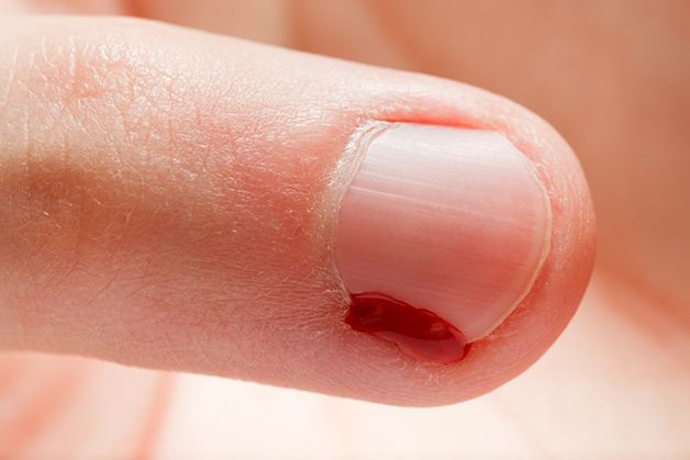 Veranderungen Der Fingernagel Deuten Friseur Com