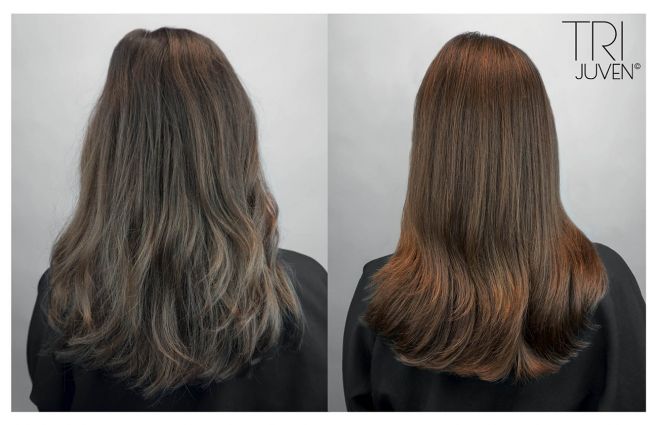 Trijuven C Die Therapie Zur Haarverjungung Friseur Com