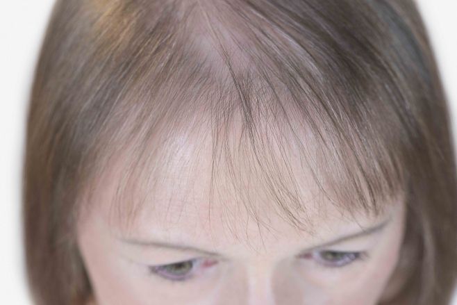 Schütteres haar für frisuren Schöne Pixie
